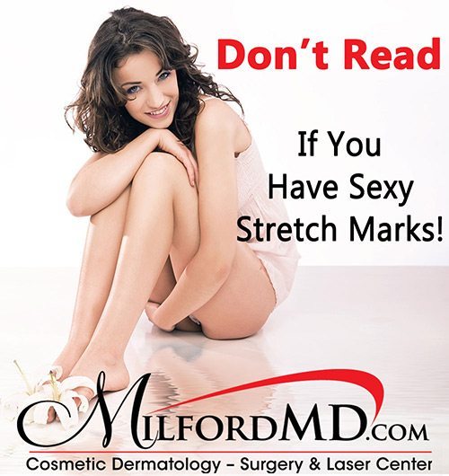 Sexy Stretch Marks By MilfordMD