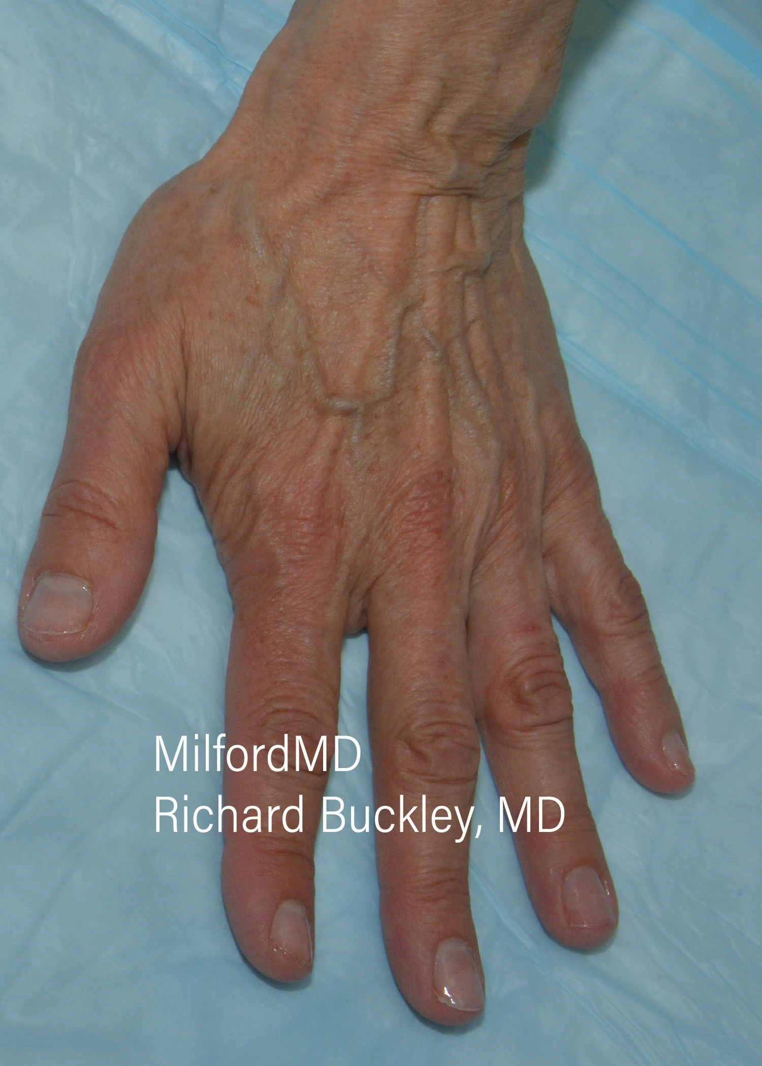 before-treatment-thumb-img