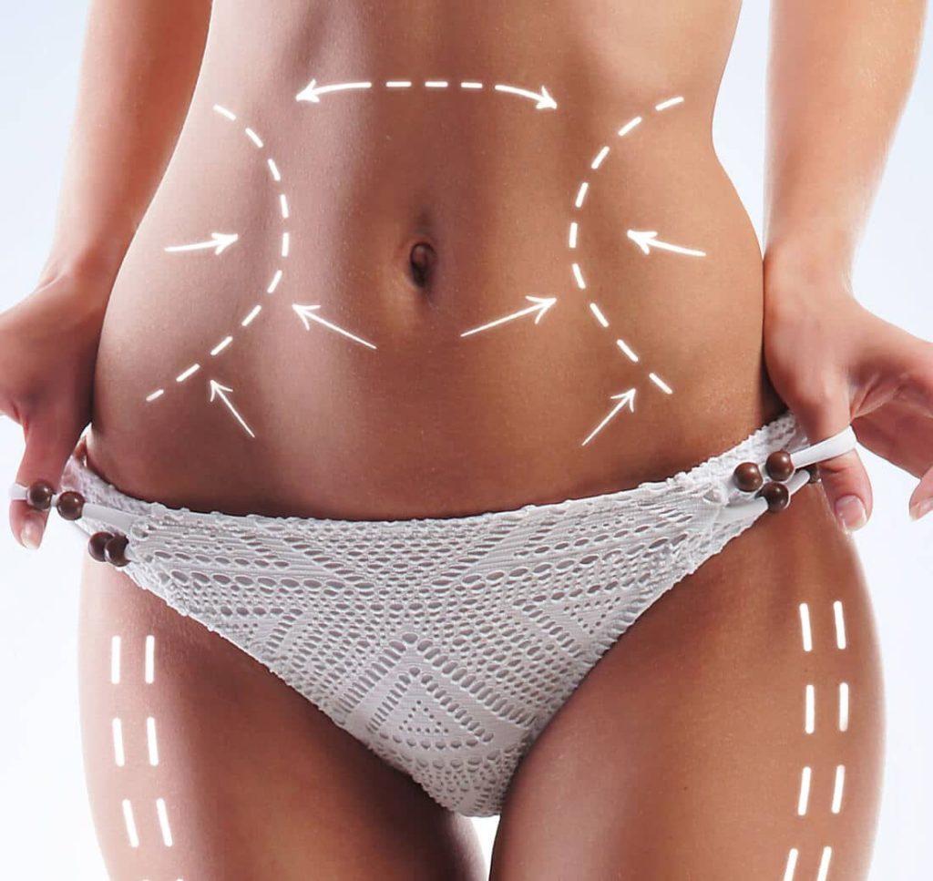 landing smartlipo one by MilfordMD